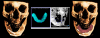 Fig 6. Practitioners can overlay computed tomography (CT) scans for treatment planning in multiple software platforms.