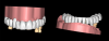 Fig 11. The practitioner can export virtually a line scan and overlay it with a digital surgical model of teeth relative to ideal teeth verified virtually in the patient’s face.