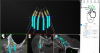 Fig 14. Topographical landmarks on the bony surfaces are used as 3D blueprints for implant planning.